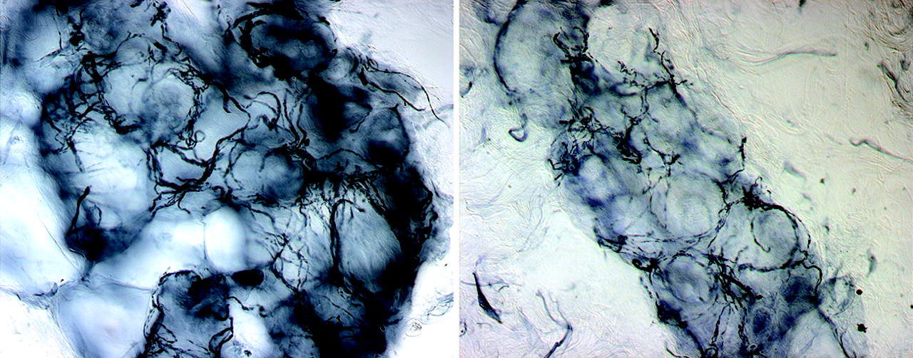 Petites fibres-Lauria-et-al.