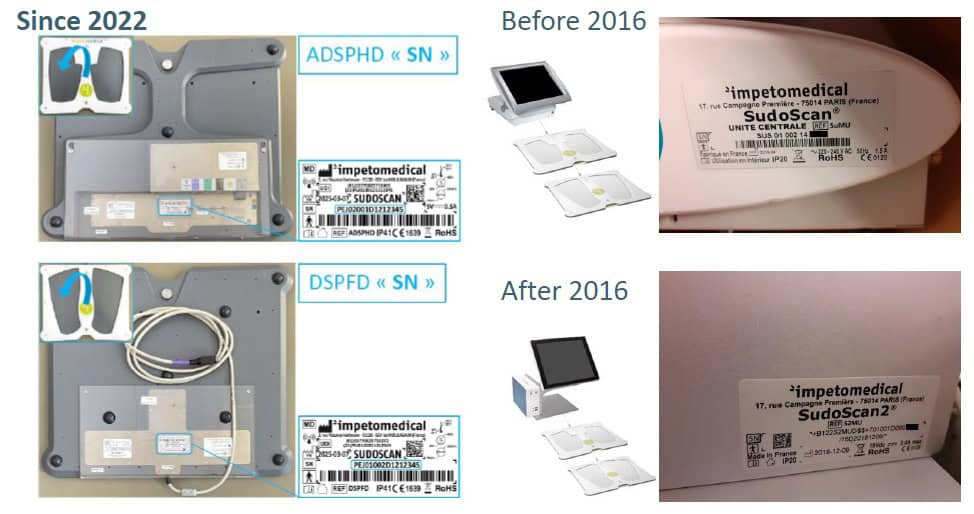 Emplacement du numéro de série sur l'appareil