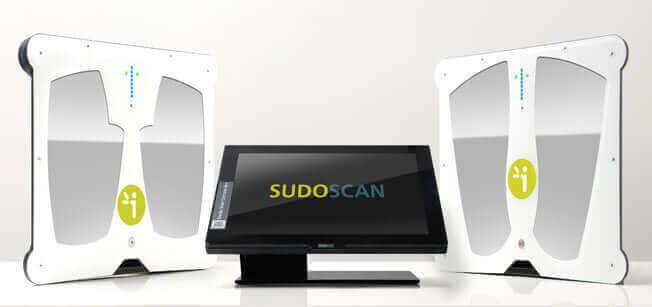sudoscan-article-Cutting-Edge-Machine-Revolutionizing-Neuropathy-Diagnosis