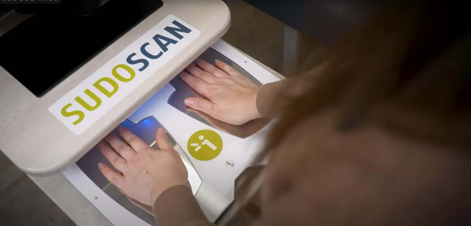 sudoscan-article-Sudoscan-Technology-Principle-A-Dynamic-Non-Invasive-Test
